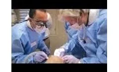 First Look: The Hahn™ Tapered Implant System - Video