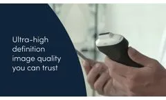 Meet the World’s First Ultra-High Frequency Handheld Ultrasound Scanner - Video