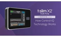 How Control-IQ Technology Works on the t:slim X2 Insulin Pump - Video