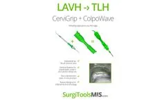 ColpoWave - Model SGT7102 - Colpotomizer- Brochure