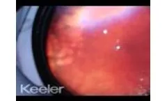 Rop Laser and Periphery Mini Clip - Video