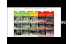 Introduction to the ExactVu 29 MHz Micro - Ultrasound Biopsy System - Video