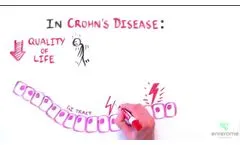 Enterome: therapeutic solutions for IBD - Video