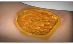 Microlyte Matrix Mechanism of Action - Video