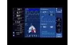 INTELLiVENT-ASV explained from setup to ventilation, on a real patient - Video