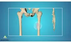 ATLANTHERA - BONE TARGETED DRUG DELIVERY CONCEPT - 12b80 MOLECULE - Video