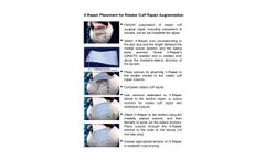 Synthasome - X-Repair Technology - Brochure