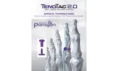 TenoTac - Model 2.0 - Soft Tissue Fixation System - Brochure