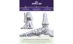 APEX 3D - Total Ankle Replacement System - Brochure