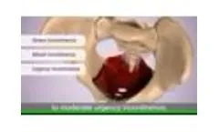 Leva Pelvic Health System Medical AnimationNOT YET RATED - Video