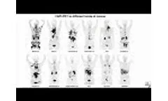 SNMMI Henry N. Wagner, Jr., Image of the Year - Video