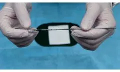 PickUp Bone Marrow Biopsy Needle - Video