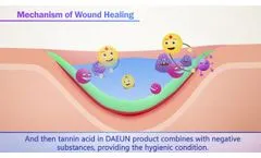 Wound Healing Technology of Daeun Medical Korea - Video