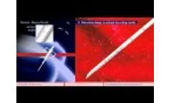 Core Biopsy - Video