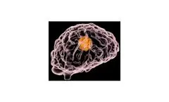 Targeting Gliomas