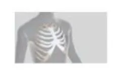 Anatomics StarPore Thoracic Reconstruction - Video