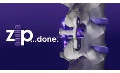 ZIP Surgical Technique Guide - Animation - Video