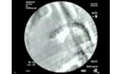 Porcine Endograft Model - Video