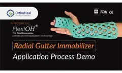 #new FlexiOH Radial Gutter (Boxer) Immobilizer for bone fracture in fingers - Video