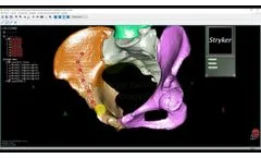 OOOPDS - Customized Plate Planning and Simulation - Video