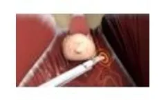 ProPep Surgical - Nerve Monitoring Animation - Video