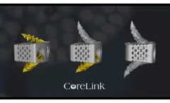 CoreLink F3D-C2 Stand-alone Cervical System with Fusation Anchors - Video