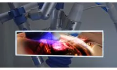 Cardiospec - Extracorporeal Shockwave Myocardial Revascularization (ESMR) - Video