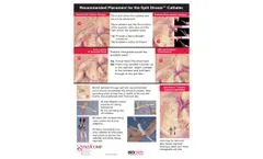 Split Stream - Long Term Hemodialysis Catheter - Brochure