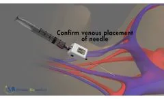Compass Vascular Access - Video