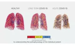 Respiratory Solutions For Better Patient Care - Quantitative Pulmonary CT - Fluidda - Video