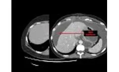 Introduction to CT Abdomen and Pelvis: Anatomy and Approach - Video