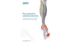 Neuromuscular Electrostimulation Device for Post-Operative Oedema Prevention - Hospital Applications- Brochure