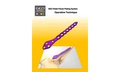 GEO - Distal Fibula Plate - Brochure