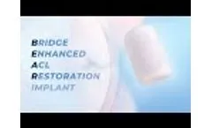 BEAR Implant Clinical Story | Surgery for ACL Tears | Miach Orthopaedics - Video