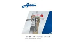 Distal Radius Fracture Fixation - Brochure