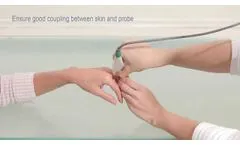 Osteoporosis Assessment by Measuring the Phalanx - Video