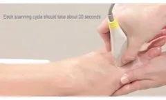 Step 6: Scan a Patient (Metatarsal) - Video