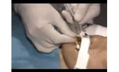 B&B Medical Technologies Universal Bite Block (Adult/Pediatric) - Video