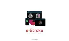 Brainomix - Version e-Stroke - Most Comprehensive Stroke Imaging Solution Brochure