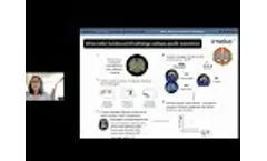 White Matter Microstructure and Alzheimer’s Disease Pathology Insights from Tractography and PET - Video