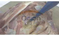 Electrosurgical unit Demo Video - ORION HA400 - Video