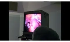 Laparoscopic Ovarian Cyst HR - Video