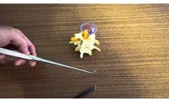 Lumbar foraminal Rasp - Video