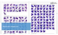 Vision Bone Marrow | Automatic analysis of bone marrow cells | West Medica - Video