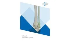 VITUS Fi Fibula Nail System - Brochure
