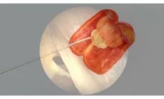 vitra S Endoscope Window Setting - Video