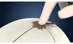 The Cranial LOOP Family at Work - Video
