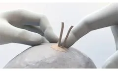Cranial Cover Burr Hole Cover - Video