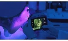 FLUORESCENCE IMAGING of wounds with the MolecuLightDX - Video
