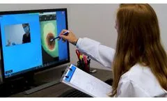 Workflow of MolecuLight i:X Telemedicine Solution for Wound Imaging - Video